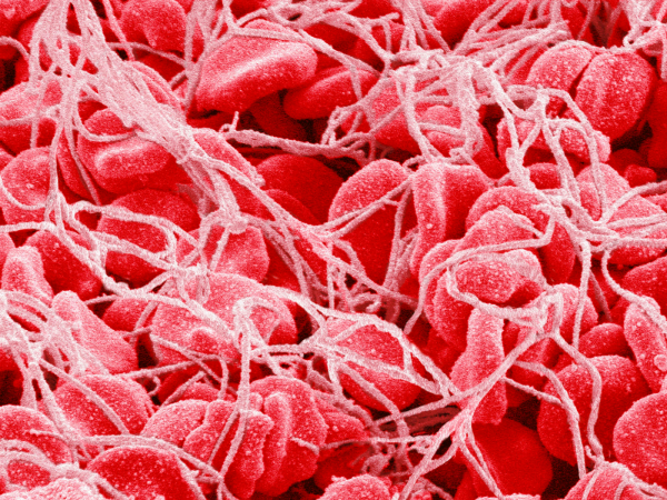Норма тромбоцитов в крови у женщин и мужчин: что это такое, как сдавать анализ