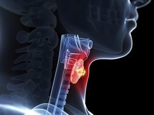 УЗИ щитовидной железы: норма, расшифровка, диагностируемые патологии