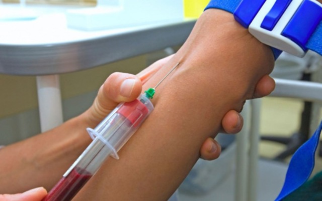 Анализ крови на ревмопробы: что это такое, как сдавать, расшифровка и норма