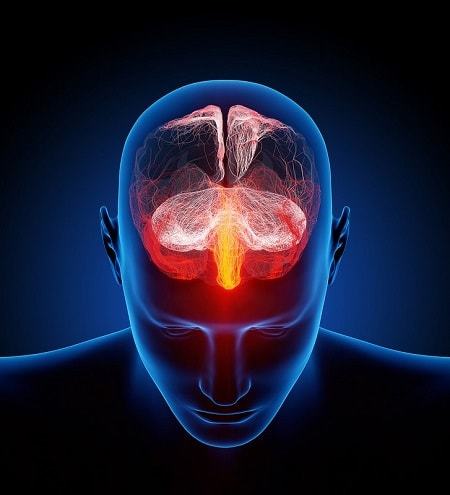 Расшифровка показателей ЭЭГ головного мозга, заключения энцефалограммы у взрослых