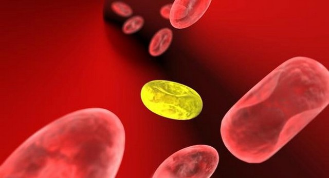 Повышенный билирубин в крови: что это значит, причины и лечение высокого уровня у взрослых