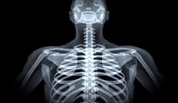 МРТ грудного отдела позвоночника: что показывает, показания, подготовка