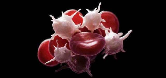 Повышенные тромбоциты в крови у женщин, мужчин: причины повышения, как снизить высокий уровень