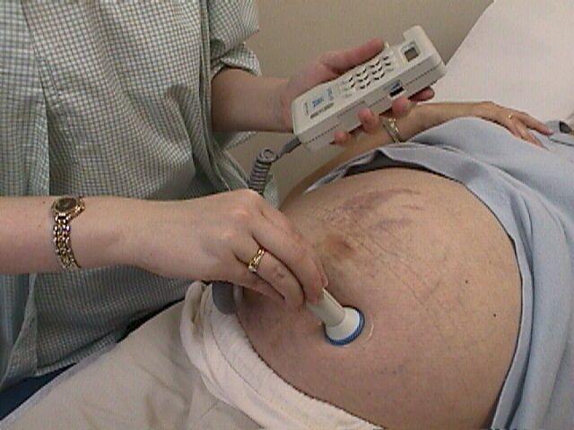 Доплер УЗИ при беременности: что это такое, подготовка к доплерографии плода