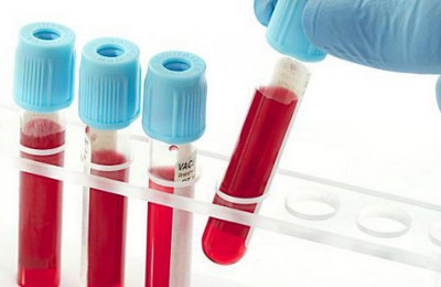 rdw в анализе крови: что это такое, почему бывает повышен, расшифровка и норма у женщин