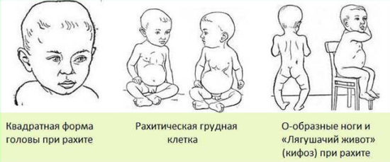 Анализ мочи по Сулковичу у грудничка, расшифровка результатов у детей