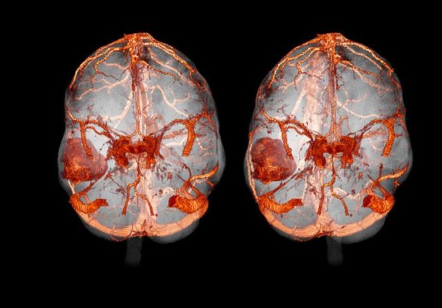 Что лучше – МРТ или КТ головного мозга: показания, подготовка, преимущества