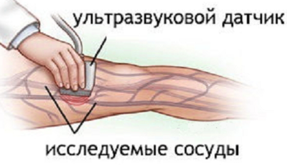 Дуплексное сканирование вен нижних конечностей, что такое УЗДГ артерий и сосудов