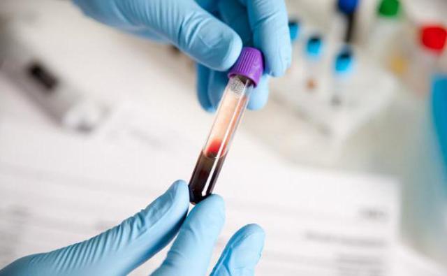 Анализ крови на РПГА: что это такое, расшифровка, показания к диагностике