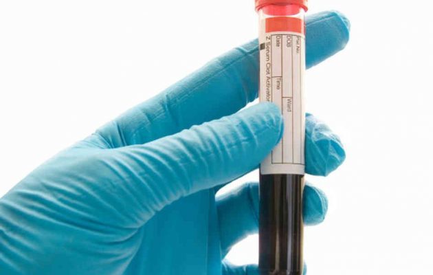 АЛТ и АСТ в анализе крови: расшифровка и норма, причины повышения уровня