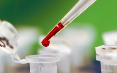 Повышены лейкоциты в крови у мужчин: причины, лечение и диагностика