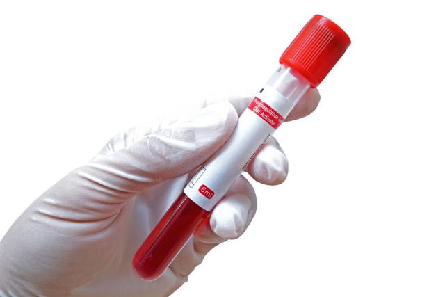 Анализ крови на РФМК: что это такое, расшифровка, почему бывает повышен