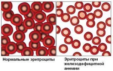 Анализ крови на ферритин: что означает, норма у женщин и мужчин, причины повышения у взрослых