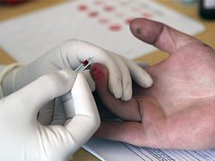 Анализ крови из пальца: что показывает, расшифровка общего анализа, как сдавать (натощак или нет)