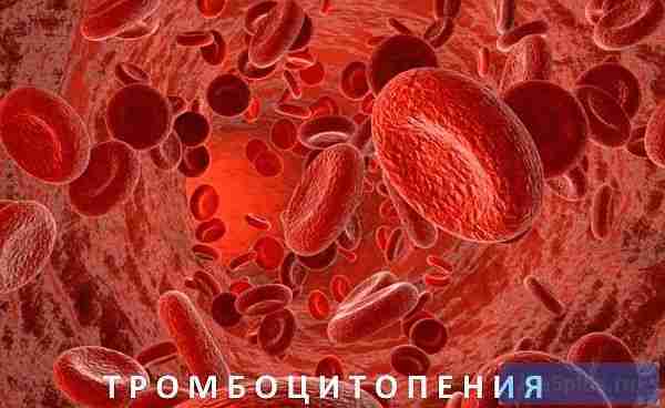 Низкие тромбоциты в крови: причины пониженного уровня, последствия у женщин, мужчин
