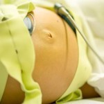 КТГ 9 баллов: что это значить при беременности, расшифровка показателей