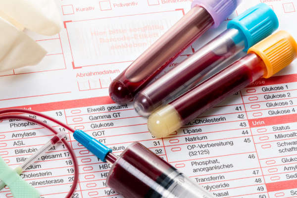 Клинический анализ крови: как сдавать, что показывает, расшифровка показателей, подготовка