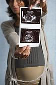 Расшифровка УЗИ при беременности: нормы плода, как расшифровать показания