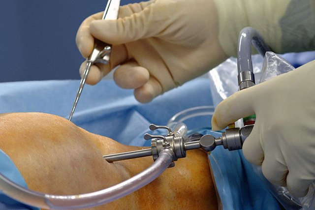 Артроскопия суставов: что это такое, отзывы о лечебно-диагностической операции