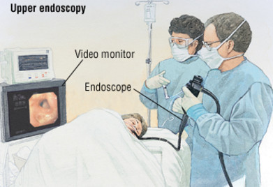 Гастроскопия желудка без глотания зонда, особенности проведения