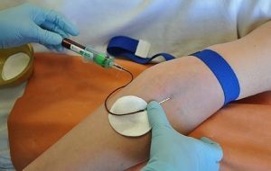 Анализ крови на гликированный гемоглобин: что означает, расшифровка, как правильно подготовиться