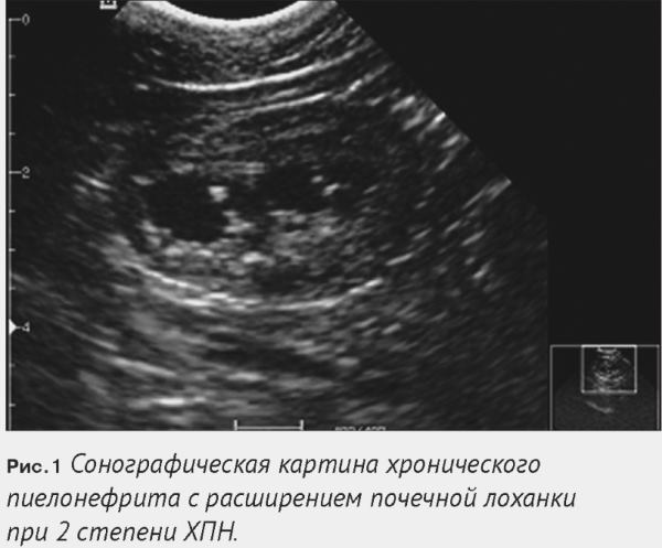 УЗИ почек при беременности: подготовка, можно ли делать беременным