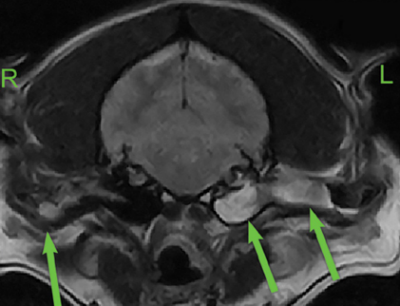 МРТ внутреннего уха: что показывает, показания и ограничения, подготовка