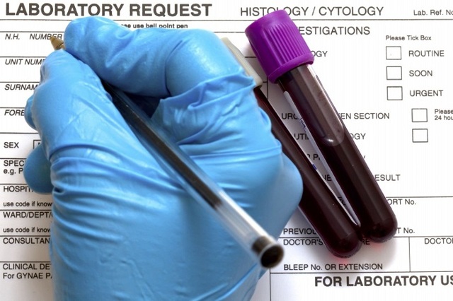 Повышена липаза в крови: причины, что это значит, подготовка к биохимическому анализу