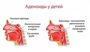 Эндоскопия носоглотки: отзывы, что это такое, показания к эндоскопическому исследованию носа
