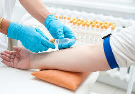 Подготовка к сдаче анализа крови на ТТГ, как правильно сдавать (натощак или нет)