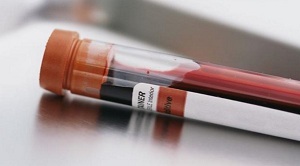 Анализ крови на гликированный гемоглобин: что означает, расшифровка, как правильно подготовиться