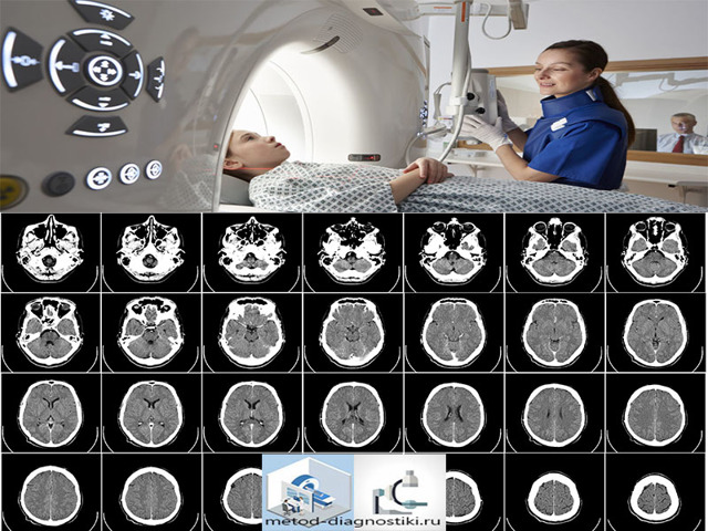 Что такое МРТ: как проводится магнитно-резонансная томография, принцип действия диагностики