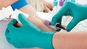 Клинический анализ крови в Хеликс: как сдавать, подготовка к биохимическому исследованию