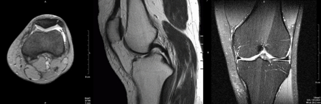 МРТ суставов: что показывает магнитно-резонансная томография сосудов, фото