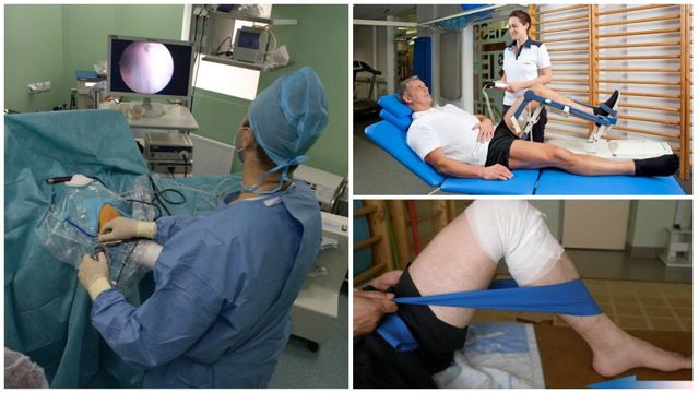 Артроскопия коленного сустава: реабилитация после операции, восстановление, ЛФК