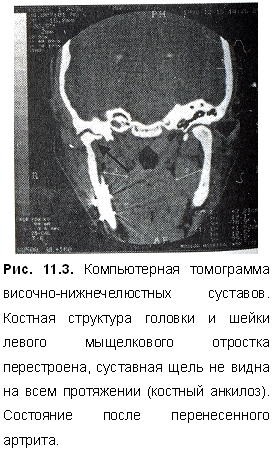Рентген челюсти и височно-нижнечелюстного сустава у детей и взрослых