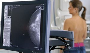 Цифровая маммография: что это такое, особенности, подготовка
