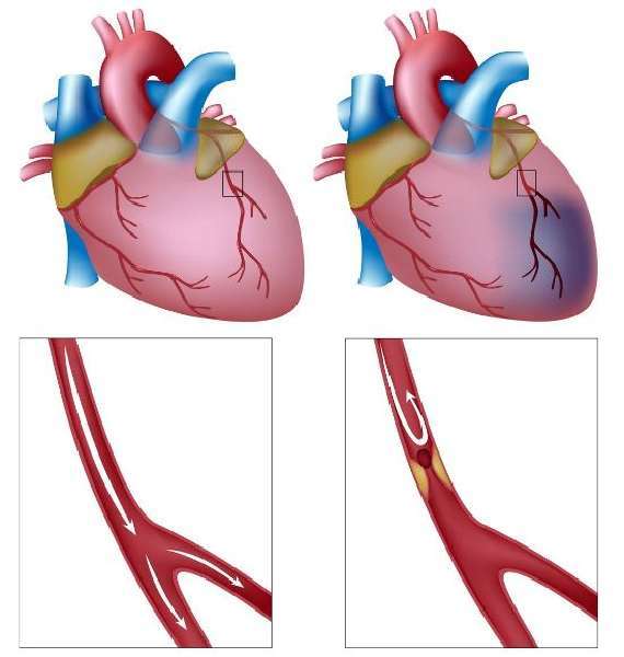Эхокардиография сердца: что это такое, как делают ЭХО-КГ, какие патологии показывает исследование