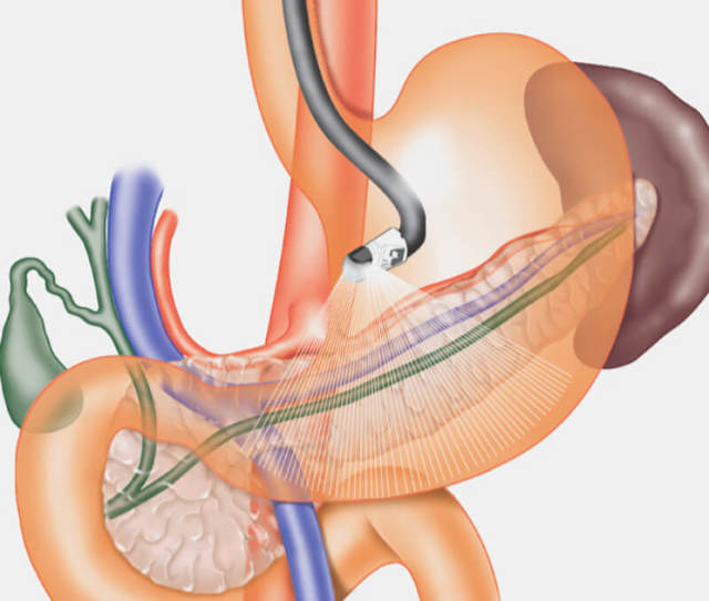 Гастроскопия желудка: отзывы, как делают, что показывает обследование, видео