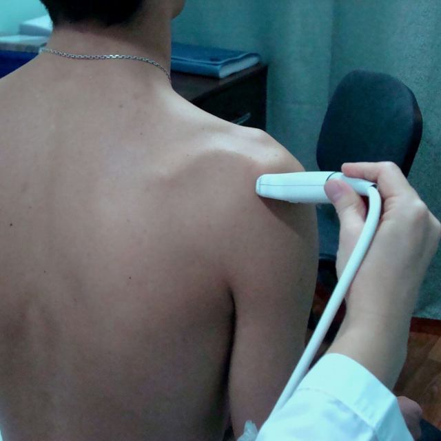 УЗИ плечевого сустава: видео, показания, особенности