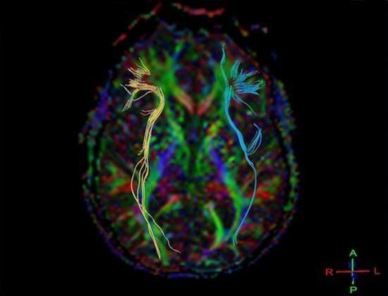 Сколько делается МРТ головного мозга, какое время длится процедура